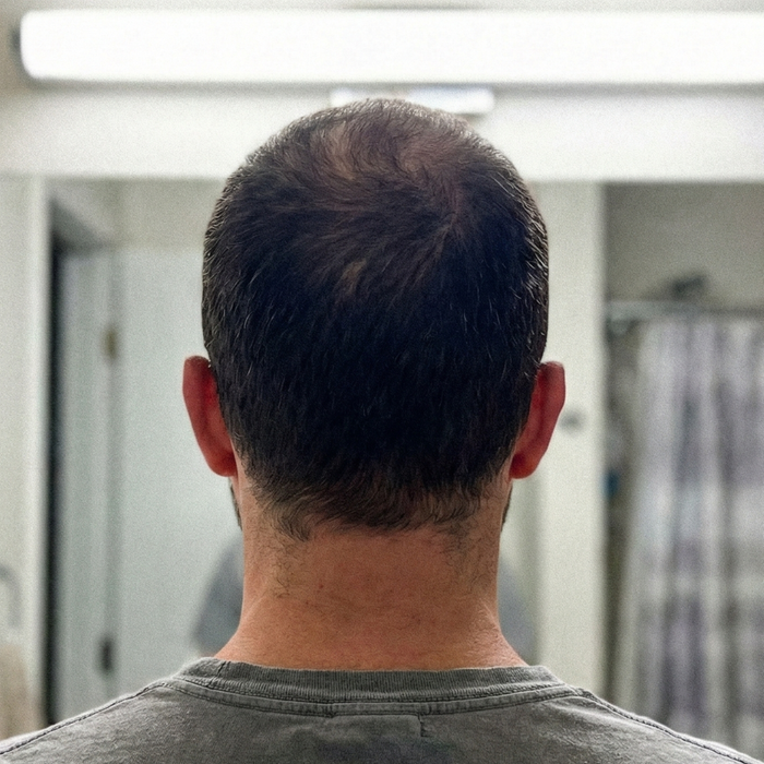 Finalmente una soluzione